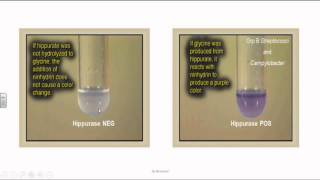 Group B Streptococci or Streptococcus Agalactia [upl. by Jamill7]