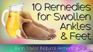 10 Home Remedies for Swollen Feet and Ankles [upl. by Nidnal]