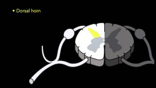 Spondylolisthesis Reduction Screw Fixation CORE Spinal System [upl. by Solrac]