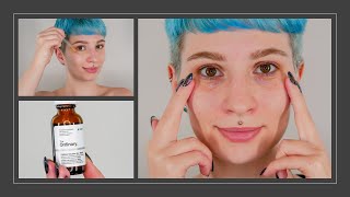 The Ordinary Caffeine Solution Review with Before and After Pictures amp Demo [upl. by Werra]