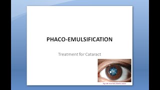 Ophthalmology 212 a PhacoEmulsification Surgery Extra Capsular Cataract Extraction [upl. by Ev]