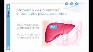 Nose Taping After Rhinoplasty How to Video [upl. by Laleb]