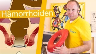 Hämorrhoiden ⚡️ Erkennen Behandeln amp Hilfsmittel [upl. by Mateusz]