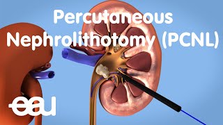 Peritoneal Cavity  Part 3  Anatomy Tutorial [upl. by Allesig886]