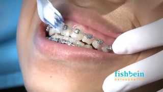 Orthodontic Home Care Instructions  Braces  Brushing [upl. by Milstone651]