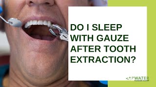 Do I sleep with gauze after tooth extraction [upl. by Schrick]