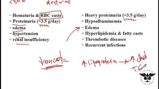 Nephrotic Syndrome  Clinical Presentation Causes and Treatment [upl. by Noryt]