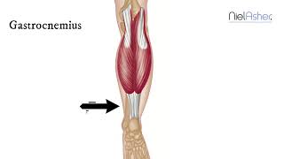 How To Find Trigger Points  Gastrocnemius [upl. by Sung]