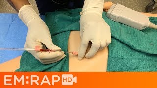 Femoral Arterial Line Placement [upl. by Naveb]