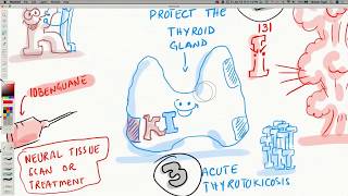 Iodine and Its Medical Uses [upl. by Nomihs411]
