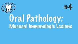 Oral Pathology  Mucosal Immunologic Diseases  INBDE ADAT [upl. by Edithe]