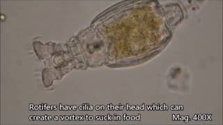 Rotifers under the microscope [upl. by Digdirb]