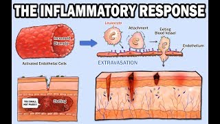 THE INFLAMMATORY RESPONSE [upl. by Louie]