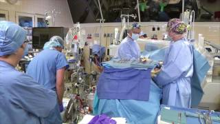 Initiation of Cardiopulmonary Bypass  Improved [upl. by Tini116]