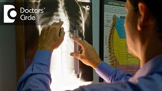 Can a chiropractor treat Scoliosis  Dr Erik W [upl. by Toshiko891]