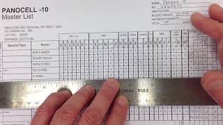 Blood Bank  Antibody Identification I [upl. by Annadiane]