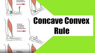 Concave Convex rule  Arthrokinematics  Orthopedics  Surgery [upl. by Inaflahk423]