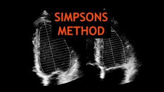 Simpsons Method Echocardiography [upl. by Rhtaeh]