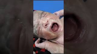 Look at the Full Vernix on Face and Body Of The New Baby BornCleaning Process With Oil youtuber [upl. by Clauddetta]