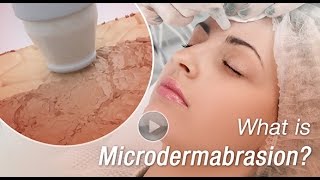 What is Microdermabrasion 3D Animation Video Explains [upl. by O'Carroll]