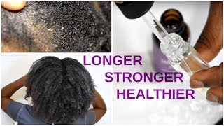 10 Lavender Oil Benefits for Natural Hair GROWTH amp SCALP REPAIR  Naturenics [upl. by Aikar]