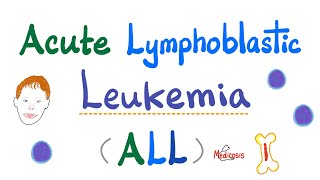 Acute Lymphoblastic Leukemia ALL  Symptoms Pathogenesis Diagnosis  Down Syndrome  Hematology [upl. by Swanhildas466]