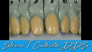 Why You Should Prep the Interproximal Wrap Veneers [upl. by Jowett]