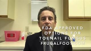 FDA Approved Options For Toenail Fungus [upl. by Guglielma37]