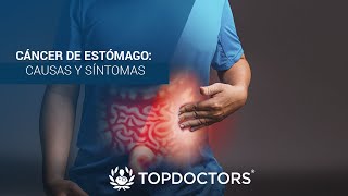 Cáncer de Estómago causas y síntomas [upl. by Port]