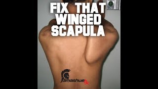 Winged Scapula Repair Protocol  Trevor Bachmeyer  SmashweRx [upl. by Ainnat]