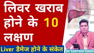 Liver Kharab Hone Ke Lakshan  Liver Damage Symptoms and Sign Explained [upl. by Pedersen405]