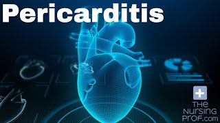 Cardiac Pericarditis [upl. by Erickson]