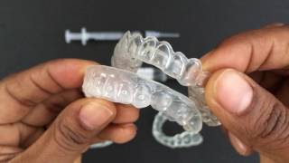 How to use Tooth Whitening Trays [upl. by Hamal]