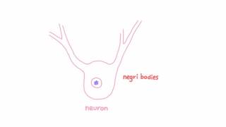 Rabies  Pathogenesis Clinical Presentation and Diagnosis [upl. by Kauppi]