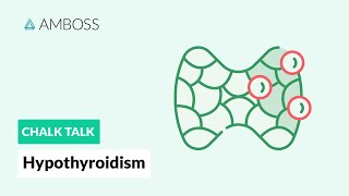 Hypothyroidism A Diagnostic Approach [upl. by Nassah]