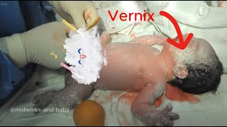 Do you know anything about the vernix layer of newborns [upl. by Fiske]