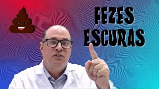 FEZES ESCURAS [upl. by Icyac]