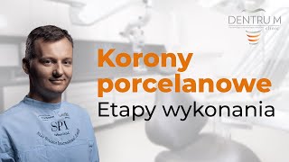 Korony porcelanowe etapy wykonania koron przez technika protetyka [upl. by Naitirb113]