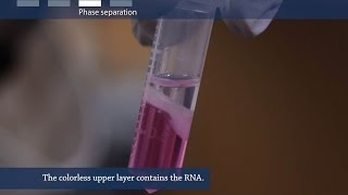 How to isolate RNA from tissue or cells [upl. by Carlotta]