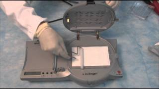 How to set up a Western part 3  The Blot Transfer using the iBlot® [upl. by Barbarese]