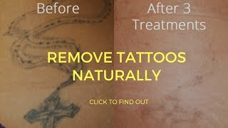 How To Remove Tattoos Naturally [upl. by Sydel116]