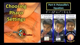 Phaco Fundamentals Part 4 Poiseuilles equation for fluidics in cataract surgery [upl. by Dailey]