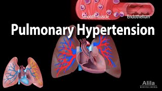 Cardiomyopathy animation [upl. by Adlar829]