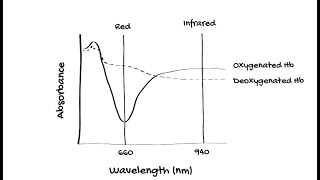 How does Pulse Oximetry work [upl. by Lleunamme402]