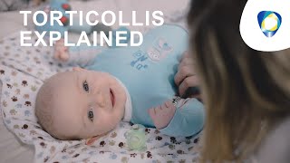 Torticollis or Cervical Dystonia New Treatment [upl. by Ayyidas]