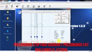 ECG CONTEC USO DE PROGRAMA [upl. by Arabella]