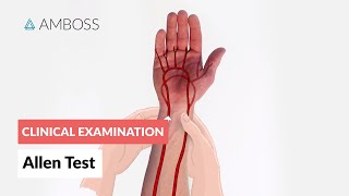 Modified Allen Test  Clinical Examination [upl. by Lavoie484]