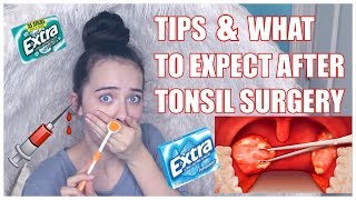 MY TONSILLECTOMY Daybyday recovery walkthrough [upl. by Josie]