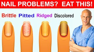 NAIL PROBLEMS  EAT THIS  Dr Mandell [upl. by Lydie]