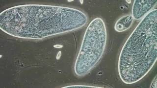 Paramecia Contractile Vacuoles by Edwin Lee [upl. by Anitsim]